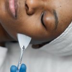 1 person getting micro needling beauty treatment 7.jpg