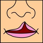 cleftlip1.jpg