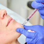 botulinum toxin injection chin.jpg