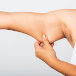 close up asian woman pulling excess fat her arm problem armpit skin studio isolated white background.jpg