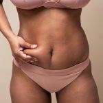 close up hand holding belly skin.jpg