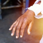 hand injury.jpg
