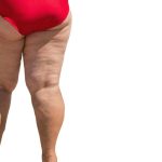 obese female legs overweight person isolated problem caused by poor diet excessive load heart.jpg