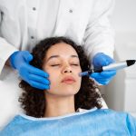 patient undergoing microneedling procedure.jpg