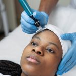person getting micro needling beauty.jpg