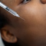 person getting micro needling beauty treatment 11.jpg
