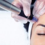shot cosmetologist making mesotherapy injection with dermapen face rejuvenation spa center.jpg