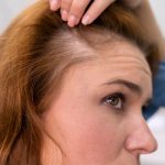 woman getting hair loss treatment clinic scaled 1.jpg